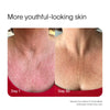 Neck & Chest Rejuvenating Mask