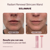 4-in-1 Red Light Therapy Wand & Activating Serum Kit