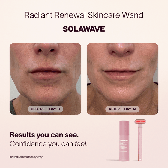 4-in-1 Red Light Therapy Wand & Activating Serum Kit